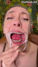 OnlyFans leaked Cum faced braces on HDthot